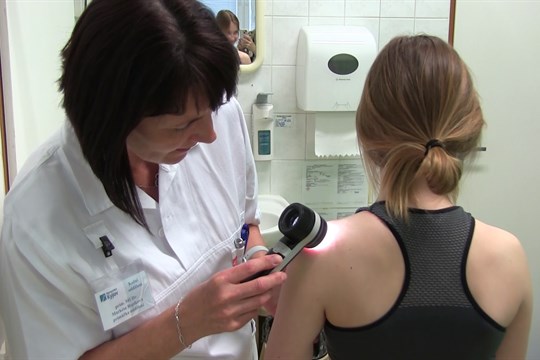 Melanomový den odhalil sedmnáct pozitivních nálezů