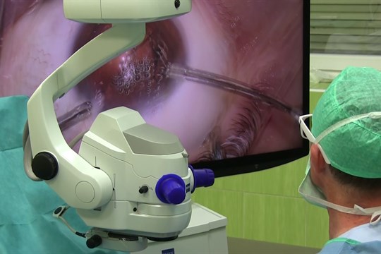 Nový mikrochirurgický přístroj na operace očí pořídila kyjovská nemocnice jako první v ČR