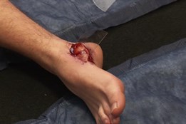 V Jablonci proběhla soutěž mladého zdravotníka