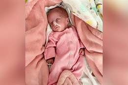 Vážila pouhých 386 gramů. Nejmenší miminko FNOL roste před očima