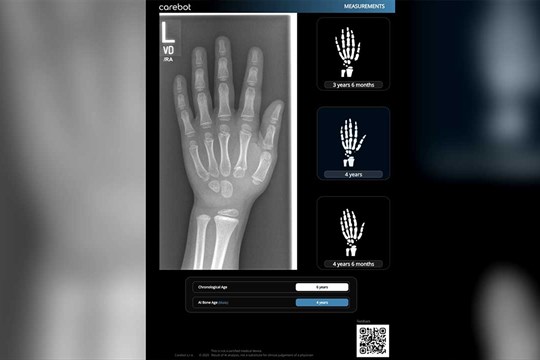 AGEL rozšiřuje nasazení umělé inteligence Carebot, míří k novému standardu diagnostiky