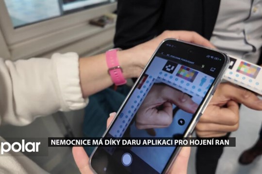 Nemocnice má díky daru aplikaci pro hojení ran