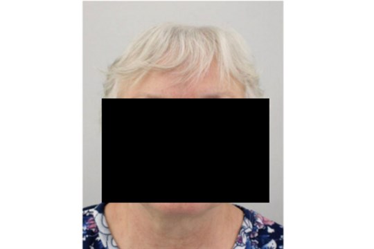 Policie hledala dezorientovanou seniorku, odešla ze zařízení v Bohumíně, našli ji živou a v pořádku