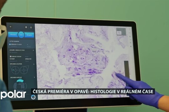 Moravskoslezská nemocnice Opava jako první v ČR zavádí do praxe takzvaný histologický skener